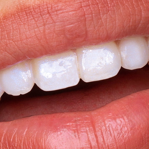 V34 Teeth Whitening Mousse